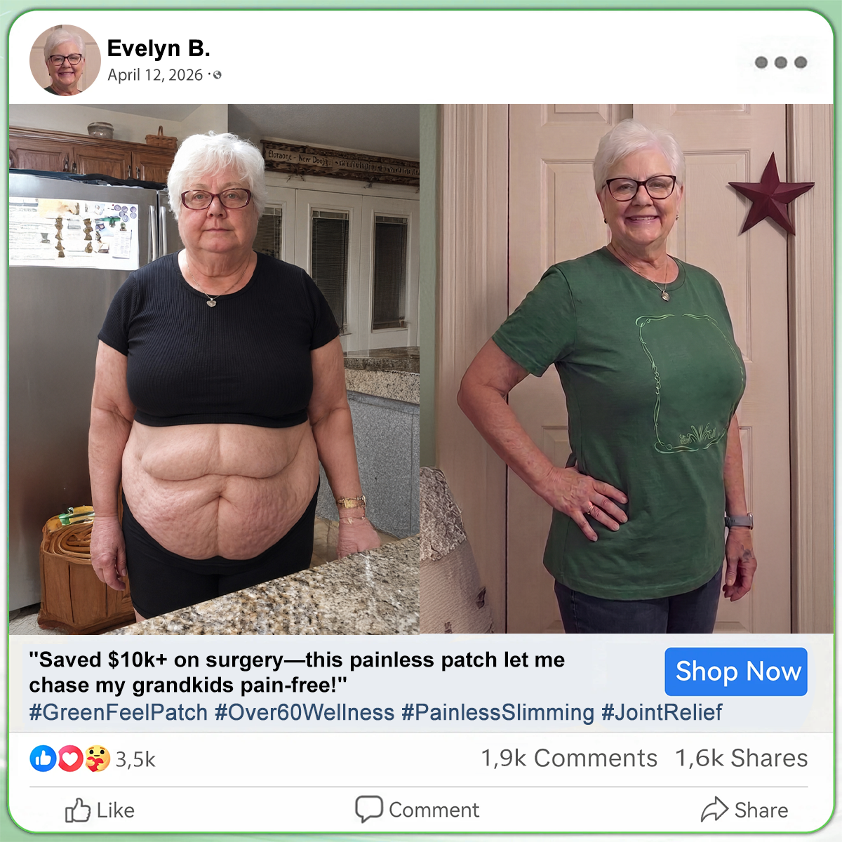 𝑶𝒇𝒇𝒊𝒄𝒊𝒂𝒍 𝑺𝒕𝒐𝒓𝒆  |🍀🍀𝐂𝐚𝐫𝐞𝐔𝐩𝐥𝐢𝐟𝐭® 𝑴𝒆𝒕𝒂𝒃𝒐𝒍𝒊𝒄 𝑵𝒂𝒏𝒐 𝑴𝒊𝒄𝒓𝒐𝒏𝒆𝒆𝒅𝒍𝒆 𝑷𝒂𝒕𝒄𝒉🇺🇸(𝐉𝐮𝐬𝐭 𝐨𝐧𝐜𝐞 𝐚 𝐝𝐚𝐲, 𝐯𝐢𝐬𝐢𝐛𝐥𝐞 𝐜𝐡𝐚𝐧𝐠𝐞𝐬 𝐢𝐧 𝟕 𝐝𝐚𝐲𝐬）𝘽𝙚𝙧𝙗𝙚𝙧𝙞𝙣𝙚 + 𝙈𝙤𝙧𝙞𝙣𝙜𝙖 𝙁𝙤𝙧𝙢𝙪𝙡𝙖 ✅ 𝐅𝐨𝐫 𝐨𝐛𝐞𝐬𝐢𝐭𝐲, 𝗟𝗼𝗼𝘀𝗲 𝘀𝗸𝗶𝗻,𝐝𝐢𝐚𝐛𝐞𝐭𝐞𝐬, 𝐬𝐥𝐞𝐞𝐩 𝐚𝐩𝐧𝐞𝐚, 𝐣𝐨𝐢𝐧𝐭 𝐢𝐬𝐬𝐮𝐞𝐬, 𝐚𝐧𝐝 𝐦𝐨𝐫𝐞💯（副本）