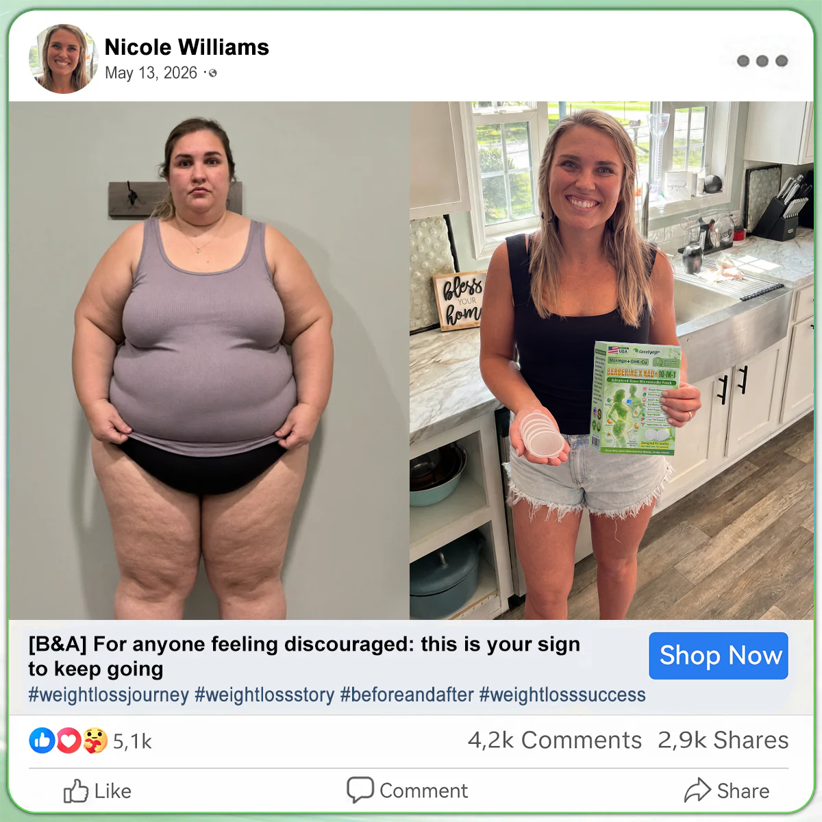 𝑶𝒇𝒇𝒊𝒄𝒊𝒂𝒍 𝑺𝒕𝒐𝒓𝒆  |🍀🍀𝐂𝐚𝐫𝐞𝐔𝐩𝐥𝐢𝐟𝐭® 𝑴𝒆𝒕𝒂𝒃𝒐𝒍𝒊𝒄 𝑵𝒂𝒏𝒐 𝑴𝒊𝒄𝒓𝒐𝒏𝒆𝒆𝒅𝒍𝒆 𝑷𝒂𝒕𝒄𝒉🇺🇸(𝐉𝐮𝐬𝐭 𝐨𝐧𝐜𝐞 𝐚 𝐝𝐚𝐲, 𝐯𝐢𝐬𝐢𝐛𝐥𝐞 𝐜𝐡𝐚𝐧𝐠𝐞𝐬 𝐢𝐧 𝟕 𝐝𝐚𝐲𝐬）𝘽𝙚𝙧𝙗𝙚𝙧𝙞𝙣𝙚 + 𝙈𝙤𝙧𝙞𝙣𝙜𝙖 𝙁𝙤𝙧𝙢𝙪𝙡𝙖 ✅ 𝐅𝐨𝐫 𝐨𝐛𝐞𝐬𝐢𝐭𝐲, 𝗟𝗼𝗼𝘀𝗲 𝘀𝗸𝗶𝗻,𝐝𝐢𝐚𝐛𝐞𝐭𝐞𝐬, 𝐬𝐥𝐞𝐞𝐩 𝐚𝐩𝐧𝐞𝐚, 𝐣𝐨𝐢𝐧𝐭 𝐢𝐬𝐬𝐮𝐞𝐬, 𝐚𝐧𝐝 𝐦𝐨𝐫𝐞💯（副本）
