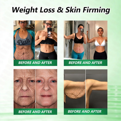 𝑶𝒇𝒇𝒊𝒄𝒊𝒂𝒍 𝑺𝒕𝒐𝒓𝒆  |🍀🍀𝐂𝐚𝐫𝐞𝐔𝐩𝐥𝐢𝐟𝐭® 𝑴𝒆𝒕𝒂𝒃𝒐𝒍𝒊𝒄 𝑵𝒂𝒏𝒐 𝑴𝒊𝒄𝒓𝒐𝒏𝒆𝒆𝒅𝒍𝒆 𝑷𝒂𝒕𝒄𝒉🇺🇸(𝐉𝐮𝐬𝐭 𝐨𝐧𝐜𝐞 𝐚 𝐝𝐚𝐲, 𝐯𝐢𝐬𝐢𝐛𝐥𝐞 𝐜𝐡𝐚𝐧𝐠𝐞𝐬 𝐢𝐧 𝟕 𝐝𝐚𝐲𝐬）𝘽𝙚𝙧𝙗𝙚𝙧𝙞𝙣𝙚 + 𝙈𝙤𝙧𝙞𝙣𝙜𝙖 𝙁𝙤𝙧𝙢𝙪𝙡𝙖 ✅ 𝐅𝐨𝐫 𝐨𝐛𝐞𝐬𝐢𝐭𝐲, 𝗟𝗼𝗼𝘀𝗲 𝘀𝗸𝗶𝗻,𝐝𝐢𝐚𝐛𝐞𝐭𝐞𝐬, 𝐬𝐥𝐞𝐞𝐩 𝐚𝐩𝐧𝐞𝐚, 𝐣𝐨𝐢𝐧𝐭 𝐢𝐬𝐬𝐮𝐞𝐬, 𝐚𝐧𝐝 𝐦𝐨𝐫𝐞💯（副本）